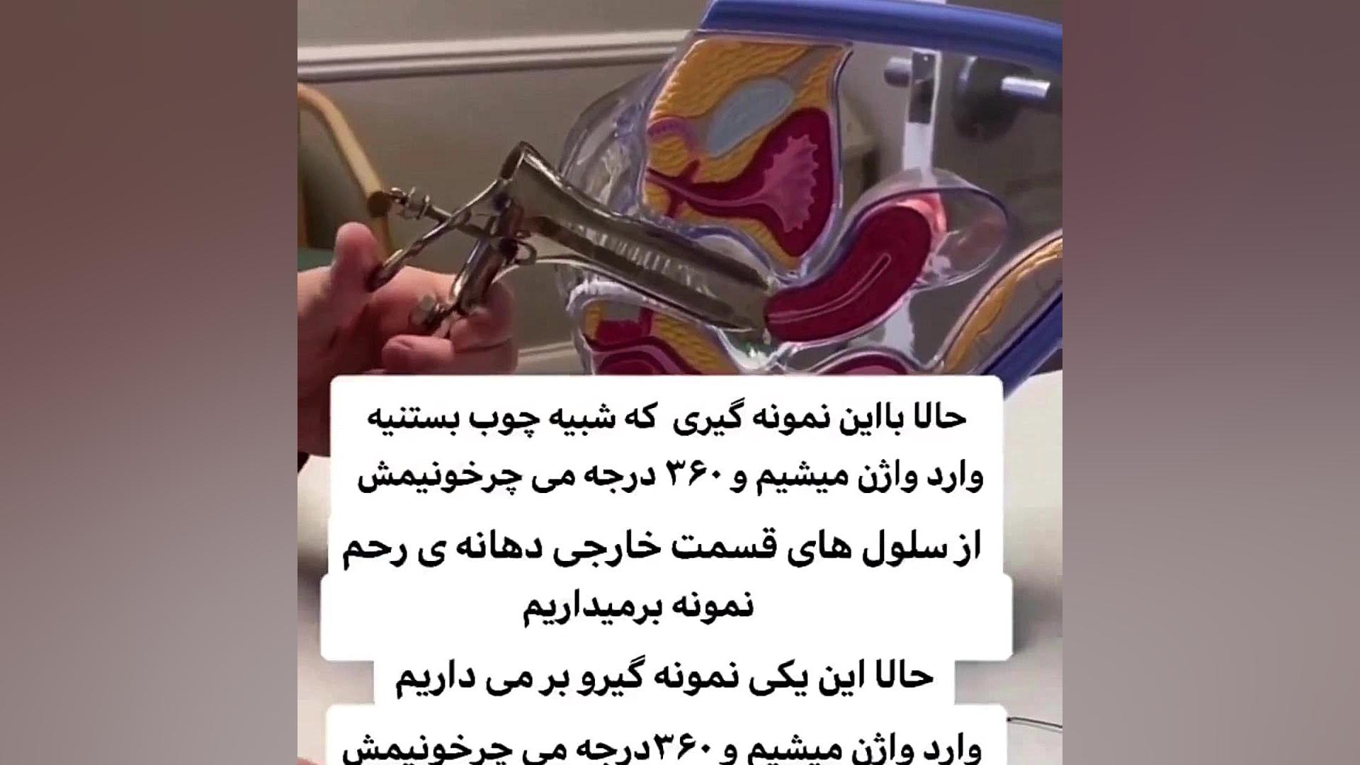 نحوه ی انجام پاپ اسمیر جراحی فک