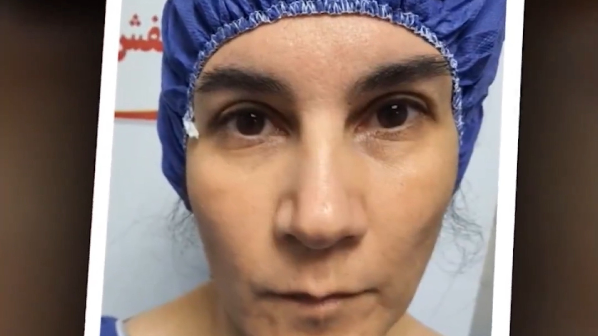 رضایت بیمار از جراحي استرابیسم چشم بیماری آلبینیزم اوکولوتئوکوتانئوس