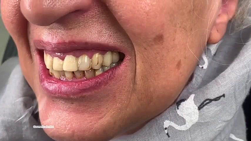 بهترین دندانپزشک زیبایی در اصفهان | دکتر محمد عاطفت دکتر محمد عاطفت متخصص ترمیمی و زیبایی اصفهان