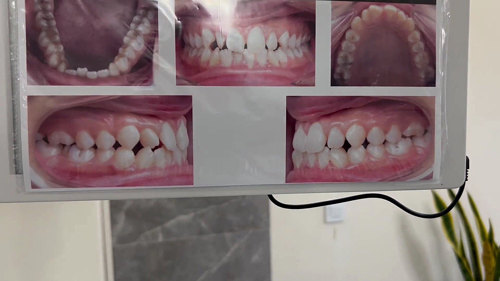 ارتودنسی در ابران دكتر مهدي فهيمي هنزائي