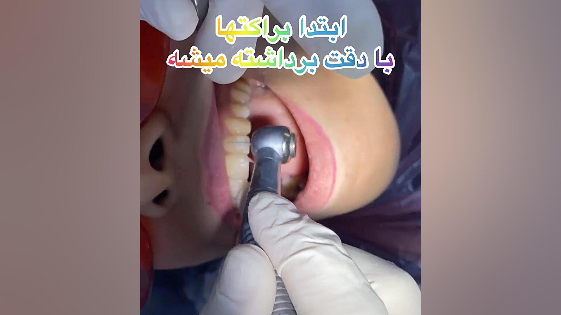 ارتودنسی غرب دكتر مهدي فهيمي هنزائي