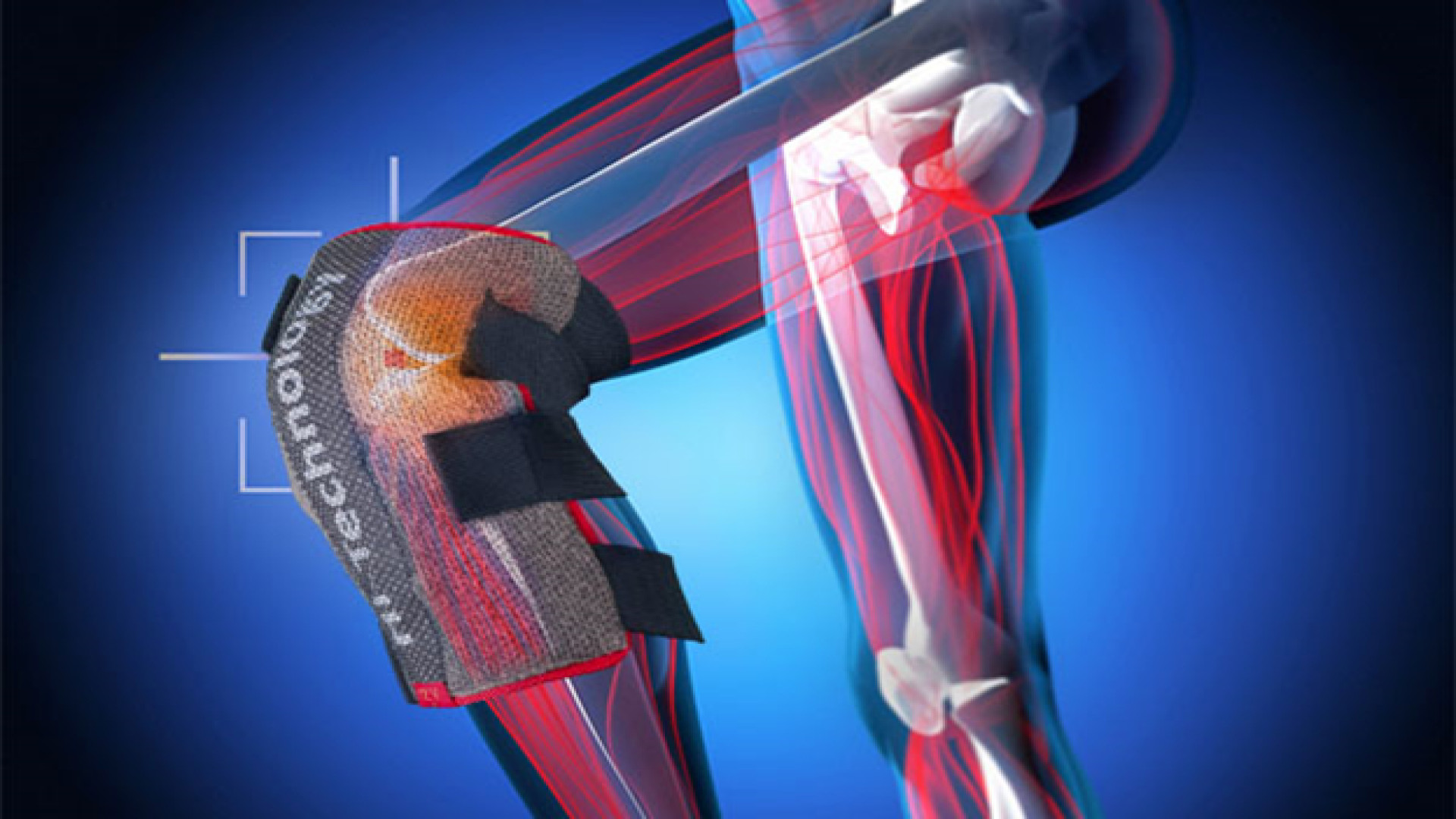 درمان ارتروز زانو_نظر مشتریان زانوبند زاپیامکس | تماس بگیرید : 09962032839 جراحی بینی