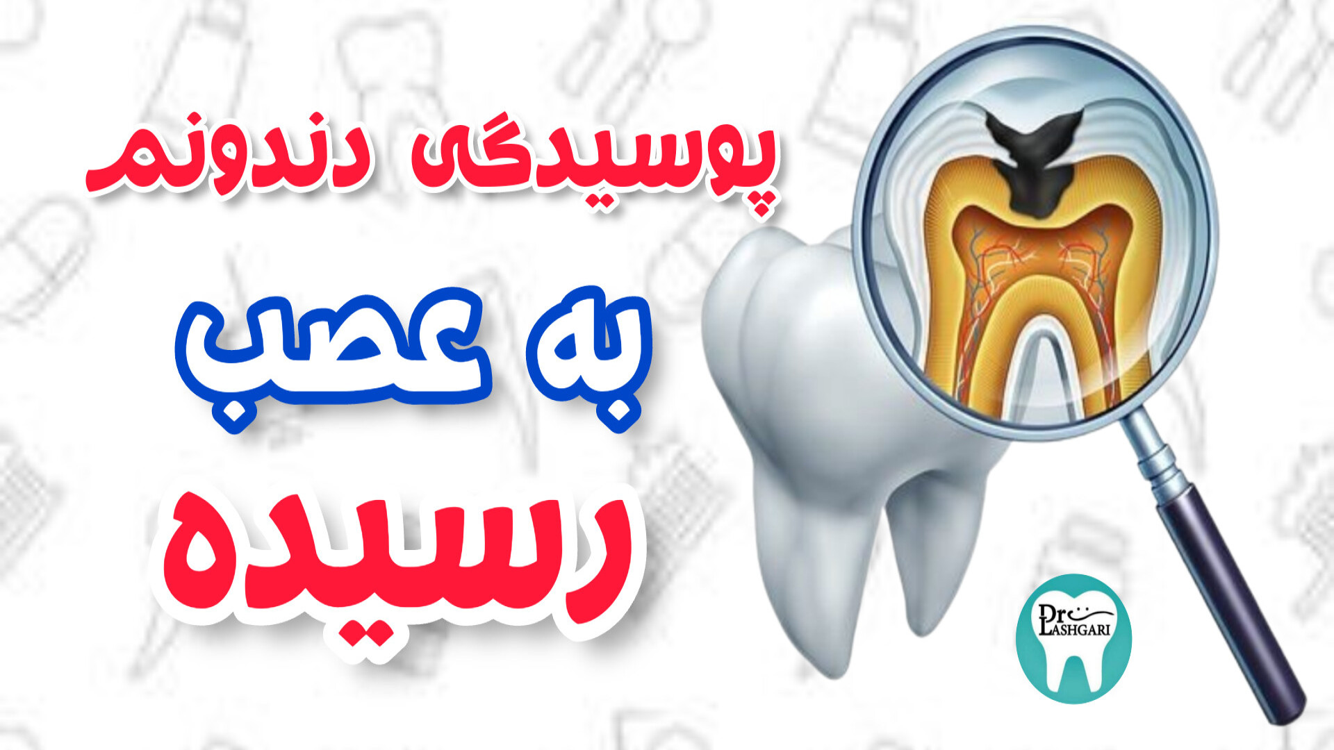 پوسیدگی دندان که به عصب رسیده کلینیک پوست
