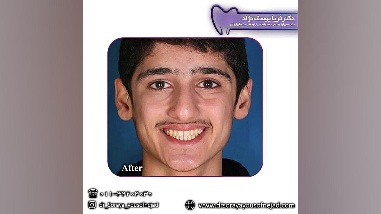 ارتودنسی دکتر ثریا یوسف نژاد متخصص ارتودنسی بابل