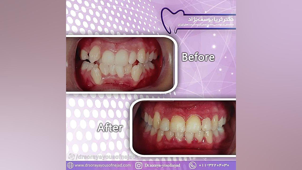 ارتودنسی دکتر ثریا یوسف نژاد متخصص ارتودنسی بابل