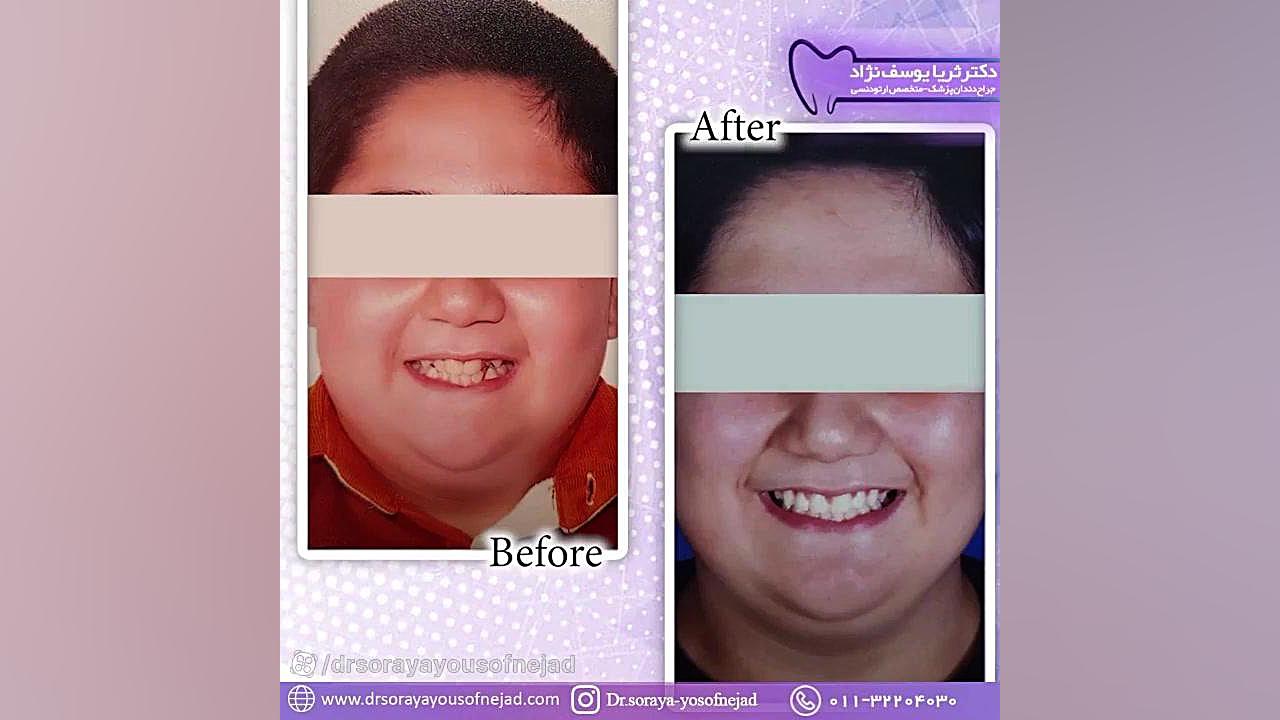 ارتودنسی دکتر ثریا یوسف نژاد متخصص ارتودنسی بابل