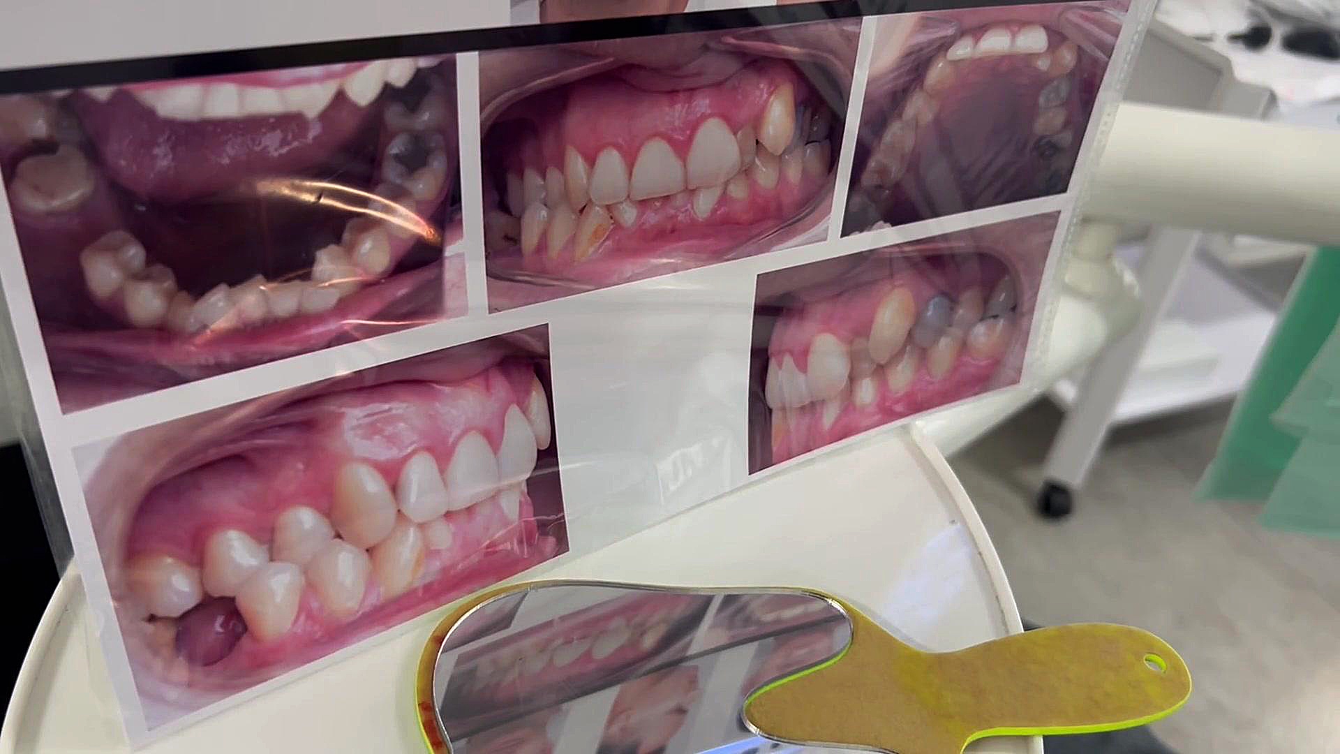 ارتودنسی باقرخان دكتر مهدي فهيمي هنزائي