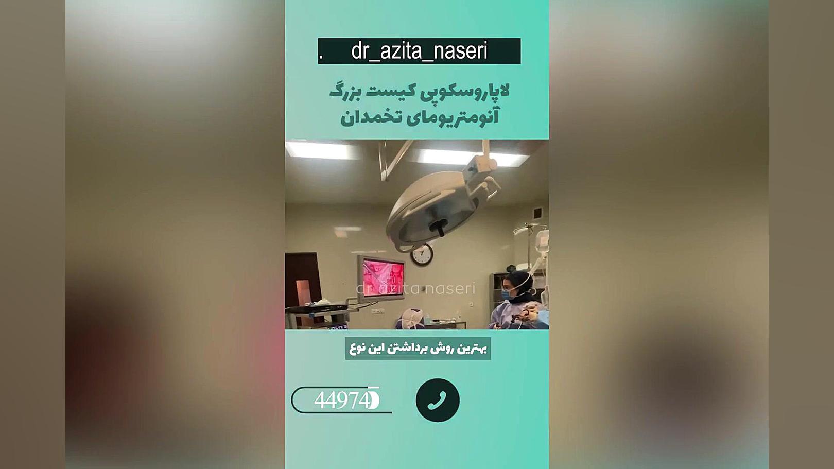 لاپاروسکوپی کیست بزرگ آنومتریومای تخمدان دکتر آزیتا ناصری