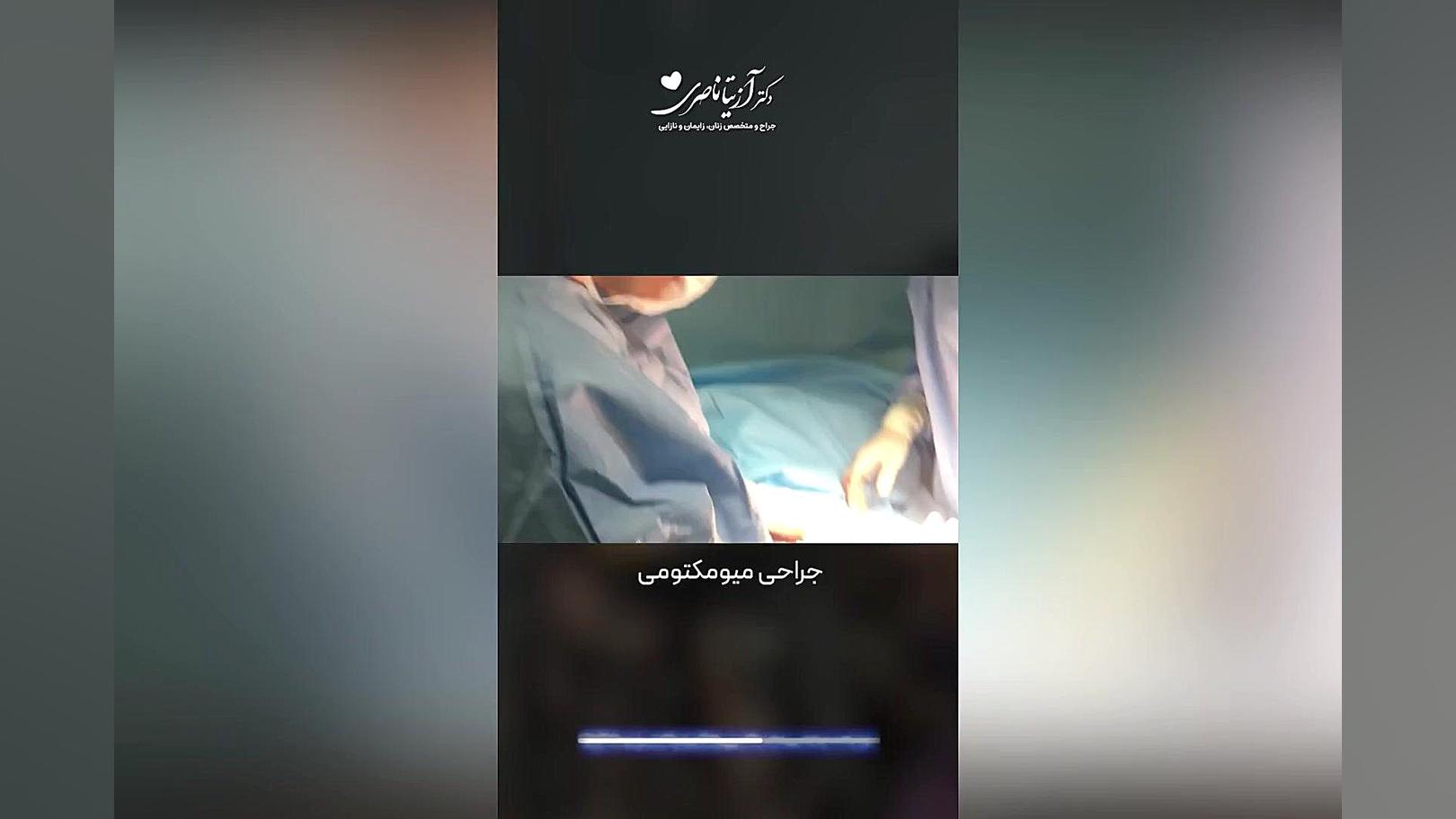 جراحی میومکتومی دکتر آزیتا ناصری