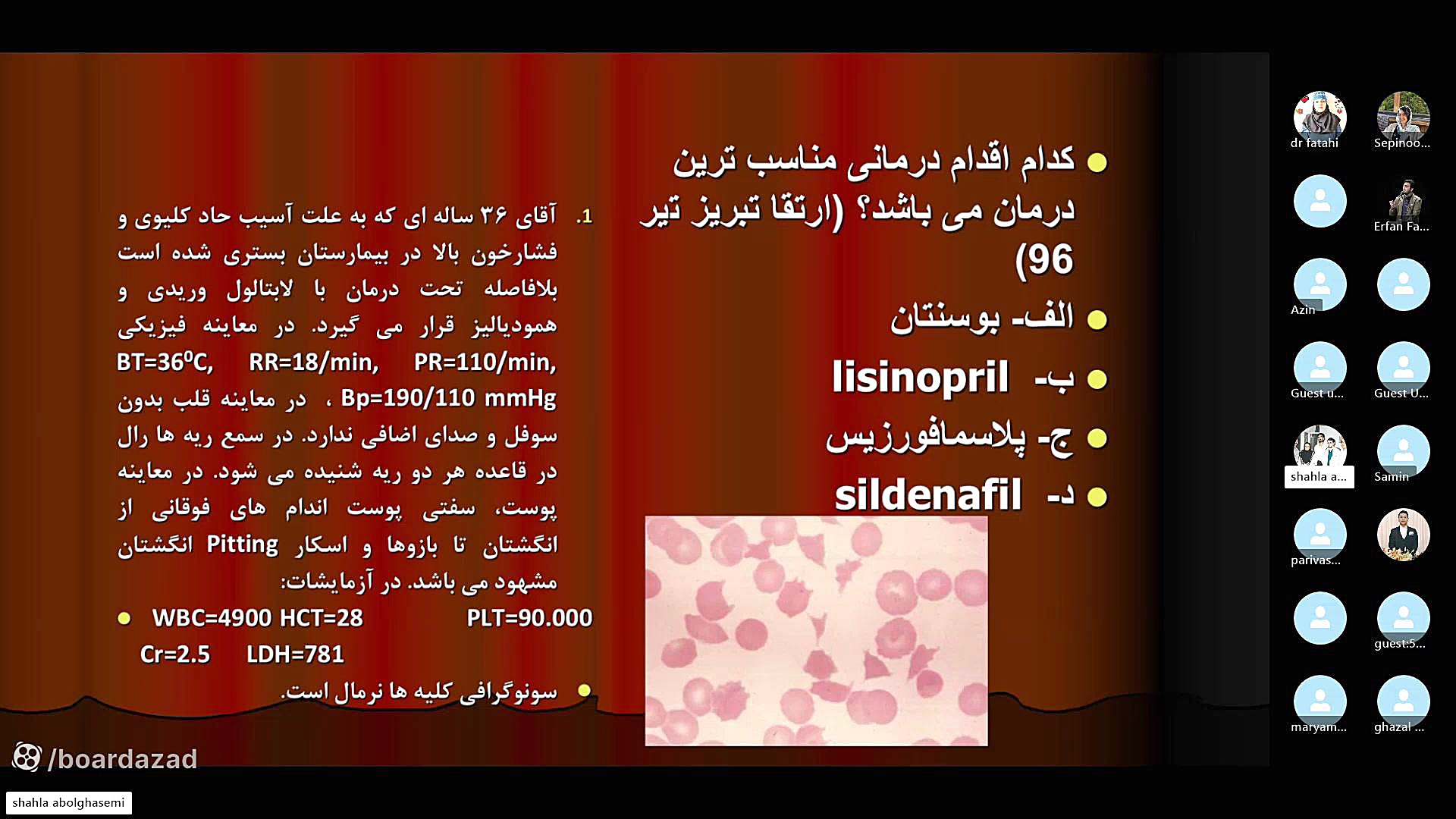 جلسه سوم تحلیل بورد داخلی - روماتولوژی - دکتر شهلا ابوالقاسمی جنیفر لوپز