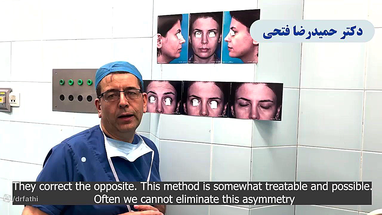 بلفاروپلاستی و لیفت اندوسکوپی ابرو دکتر حمید رضا فتحی فوق تخصص جراحی پلاستیک