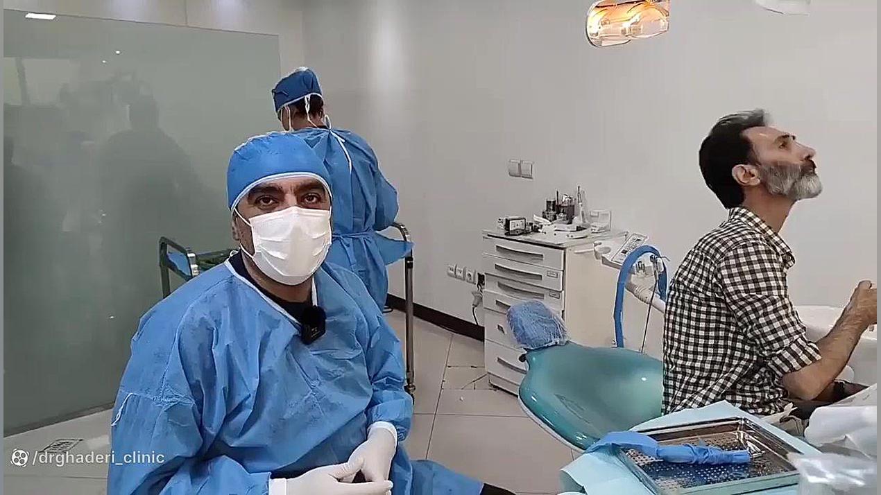 فیلم کاشت ایمپلنت فک بالا وپایین در یک جلسه تست آنتی‌بادی مونوکلونال