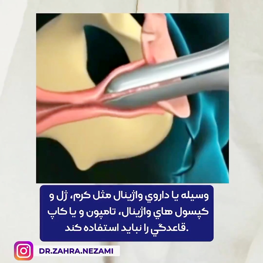 آمادگی قبل از تست پاپ اسمیر