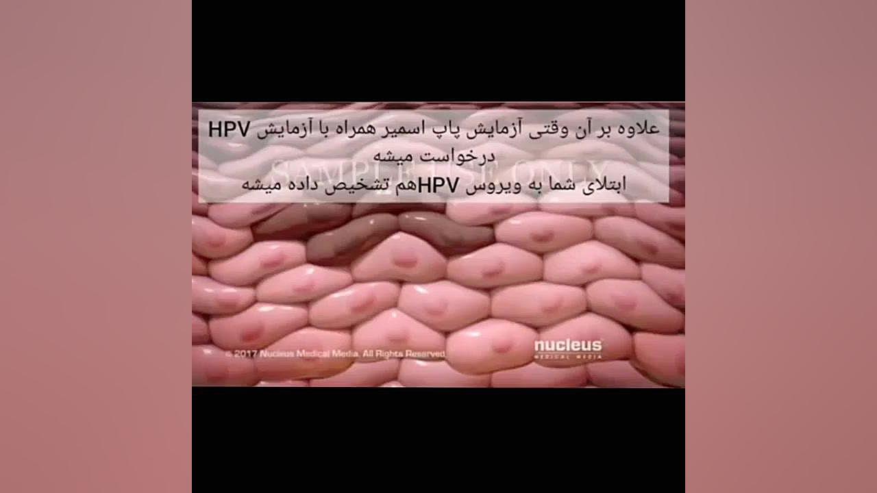تست پاپ اسمیر لیفت گردنایمپلنت دندان