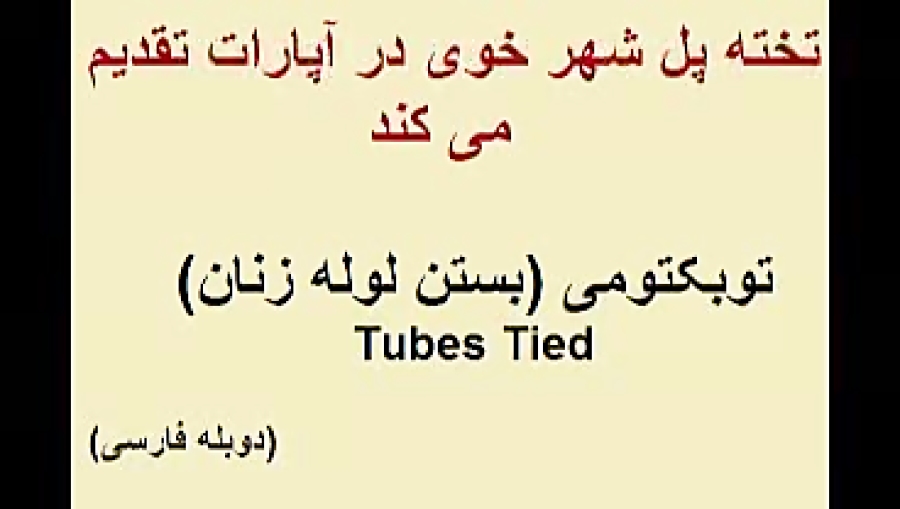 توبکتومی(بستن لوله زنان)