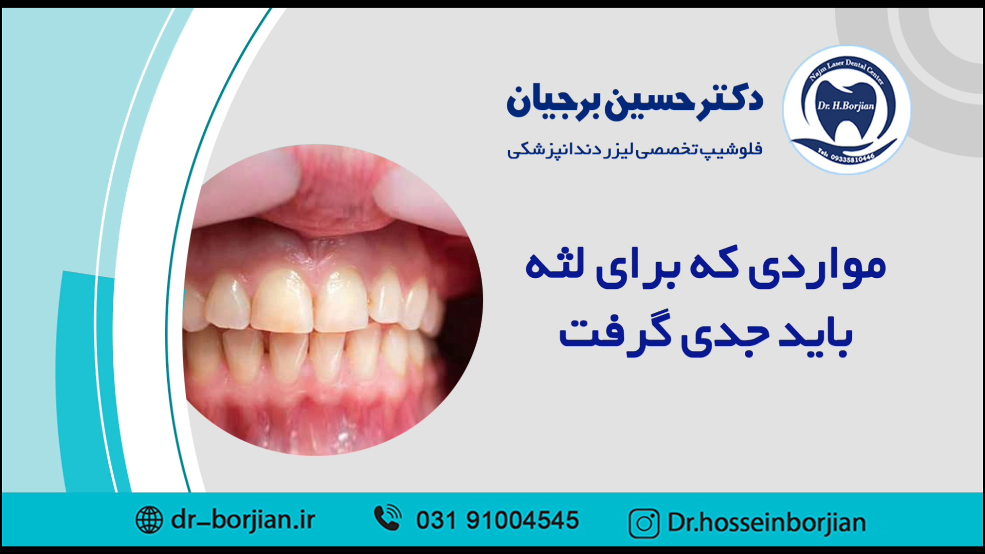 مواردی که برای لثه باید جدی گرفت | بهترین جراح لثه اصفهان ASO Test