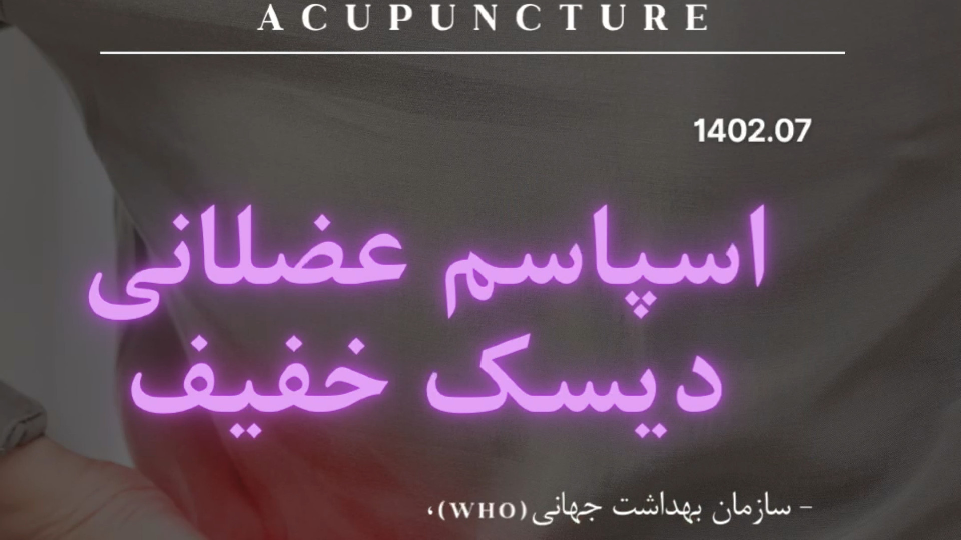 اسپاسم عضلانی ودیسک خفیف درمان با طب سوزنی در چهار روز فشرده آر اف فرکشنال