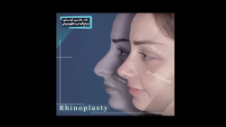 truncate dir-rtl