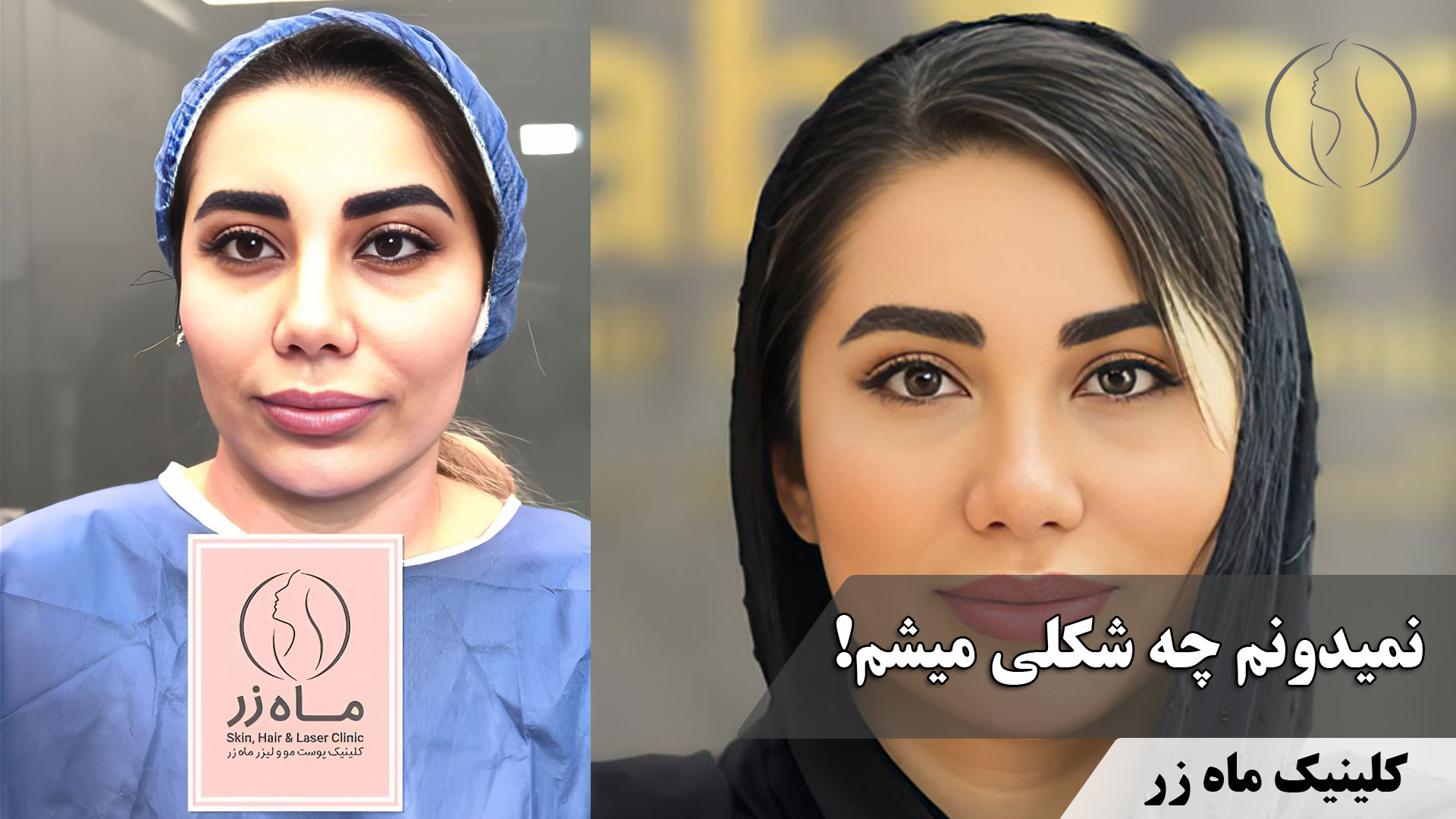تزریق چربی به صورت ( کلینیک زیبایی ماه زر ) میکروبیولوژی تطبیقی