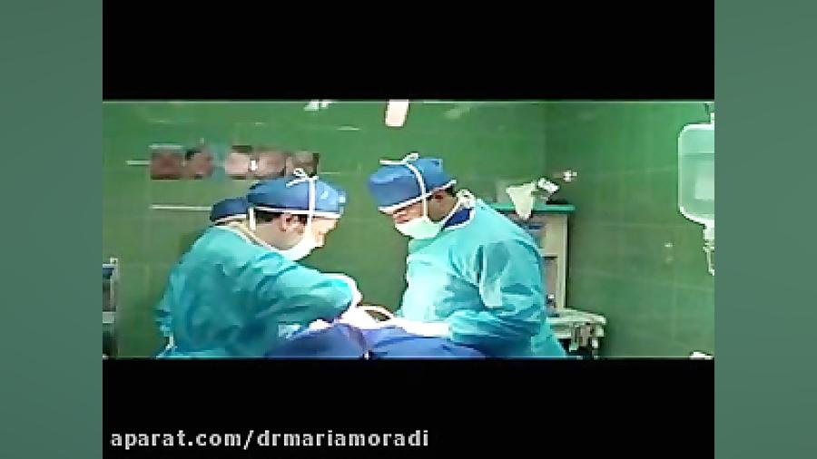 فیلم واقعی جراحی بینی کپسول اندوسکوپی