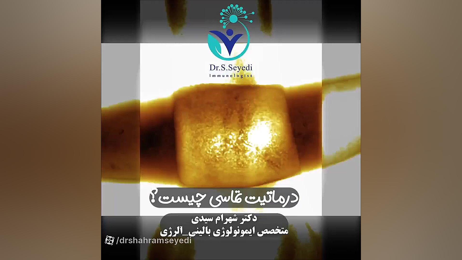 علائم درماتیت تماسی دکتر شهرام سیدی متخصص آلرژی و ایمونولوژی