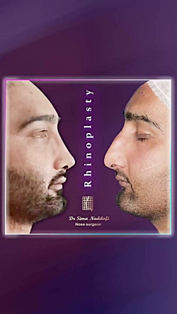 truncate dir-rtl
