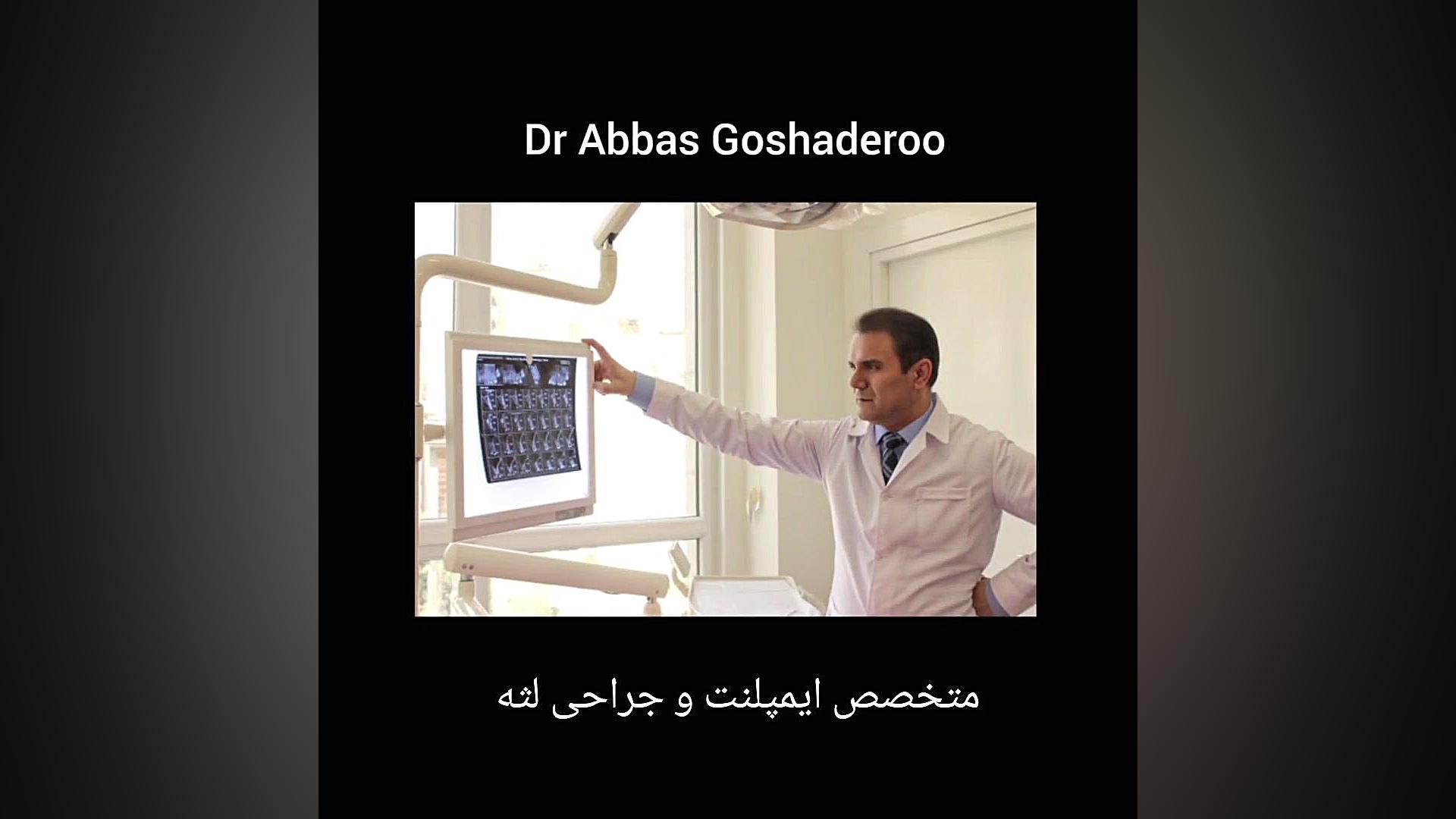 نمونه های درمانی دکتر عباس گشاده رو دکتر عباس گشاده رو، متخصص جراحی لثه و ایمپلنت