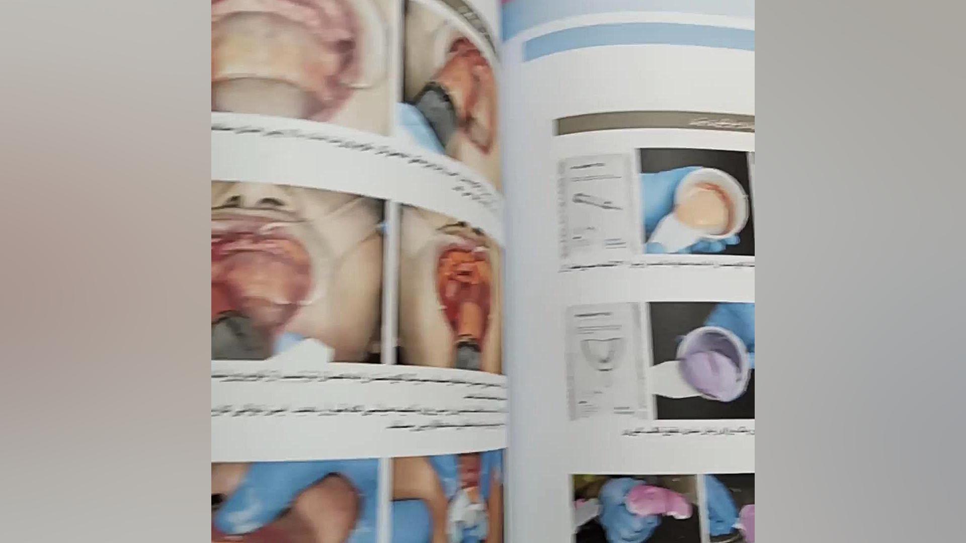 کتاب همه میتوانند به پروتز کامل فک پایین با ساکشن دست یابند Live Cell Microscopy