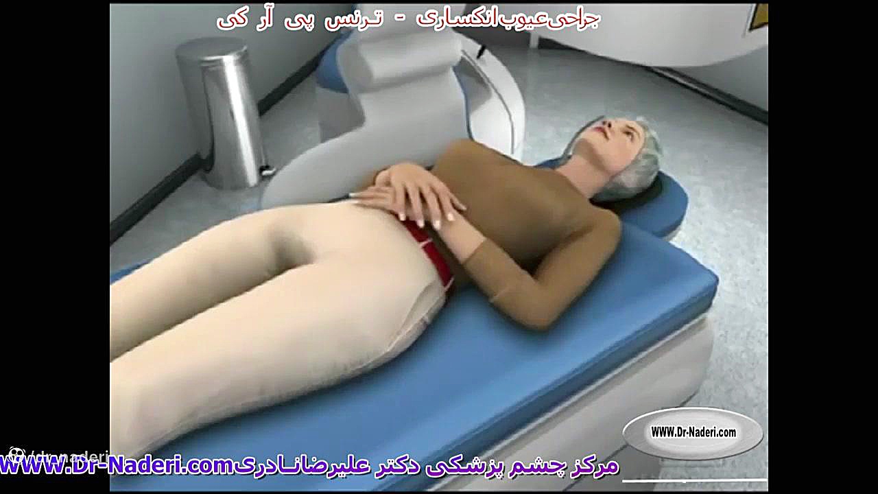 ترانس پی آر کی Trans PRK - مرکز چشم پزشکی دکتر علیرضا نادری مرکز چشم پزشکی دکتر علیرضا نادری www.dr-naderi.com