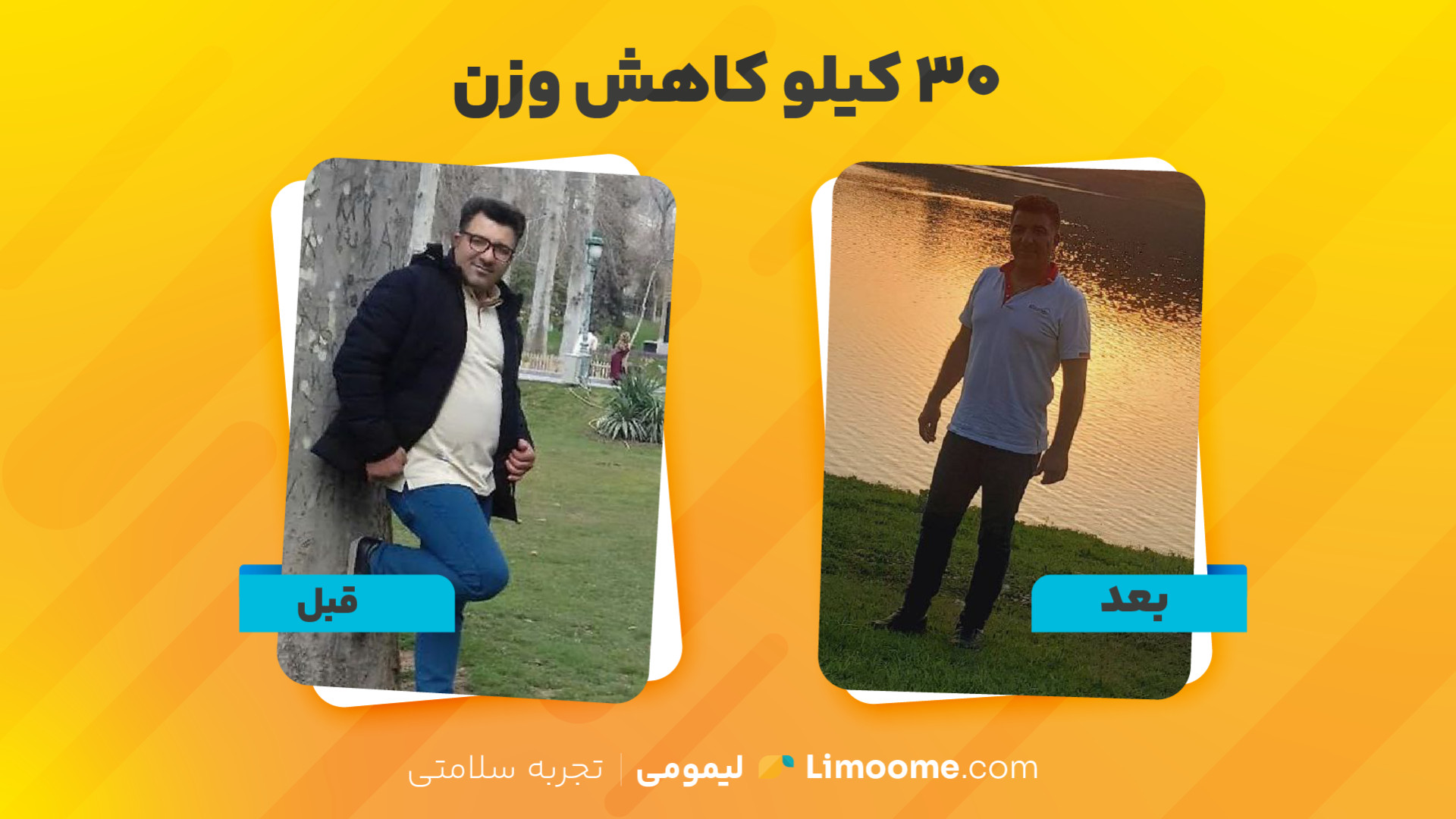 30 کیلو کاهش وزن با لیمومی کلینیک مو