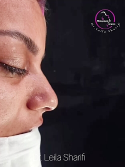 دکتر لیلا شریفی - جراح بینی در شیراز