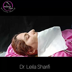 نمونه عمل بینی دکتر لیلا شریفی