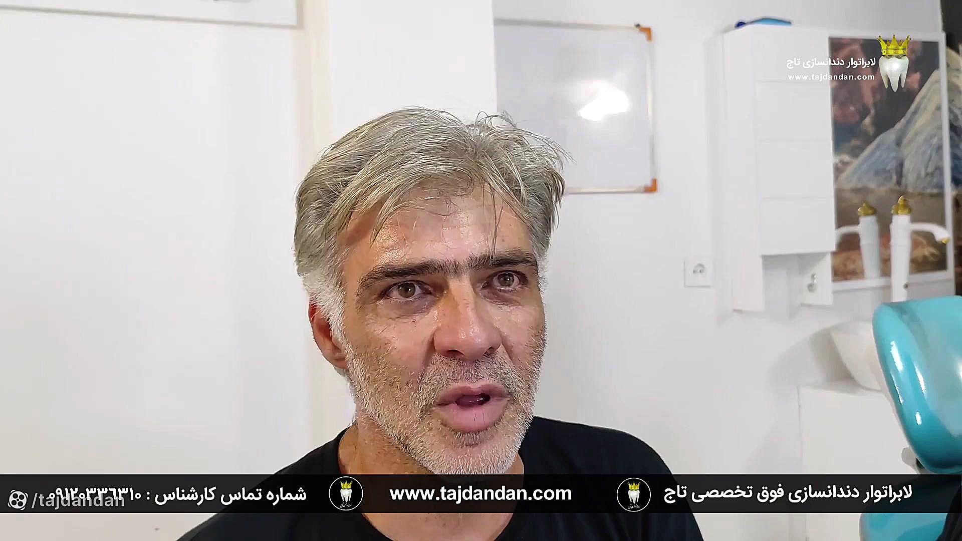 رضایت بیمار قدیمی و معرفی دوستش برای ساخت دندان مصنوعی اریتروبلاستوز جنینی