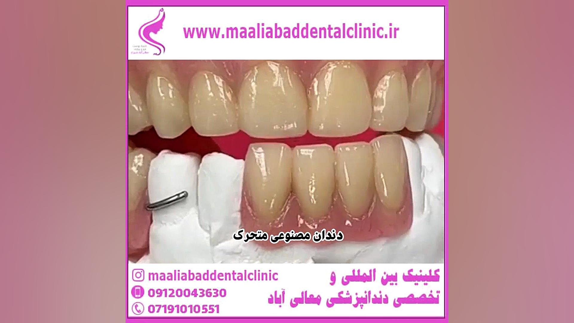 دندان مصنوعی متحرک پوشش زخم هیدروکلوییدی