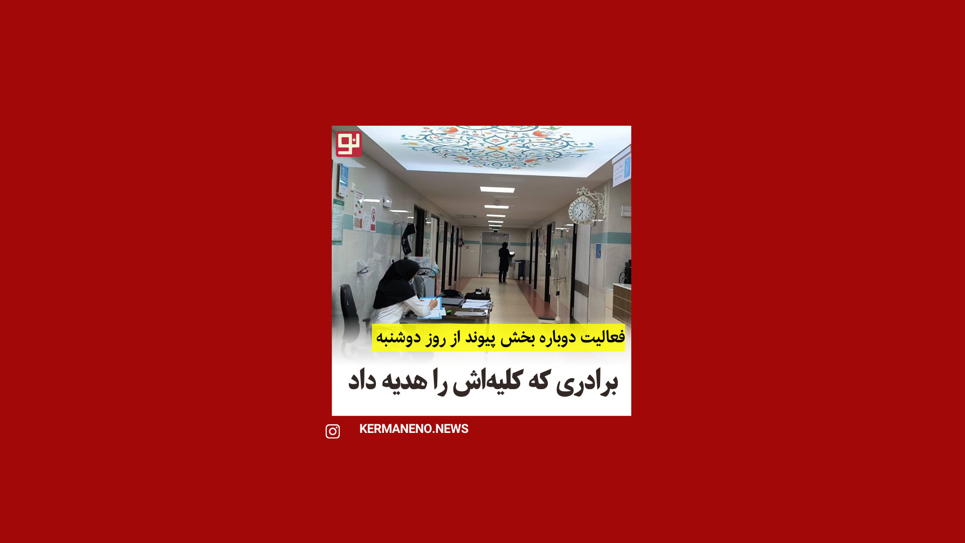فعالیت دوباره بخش پیوند از روز دوشنبه لیزر مو