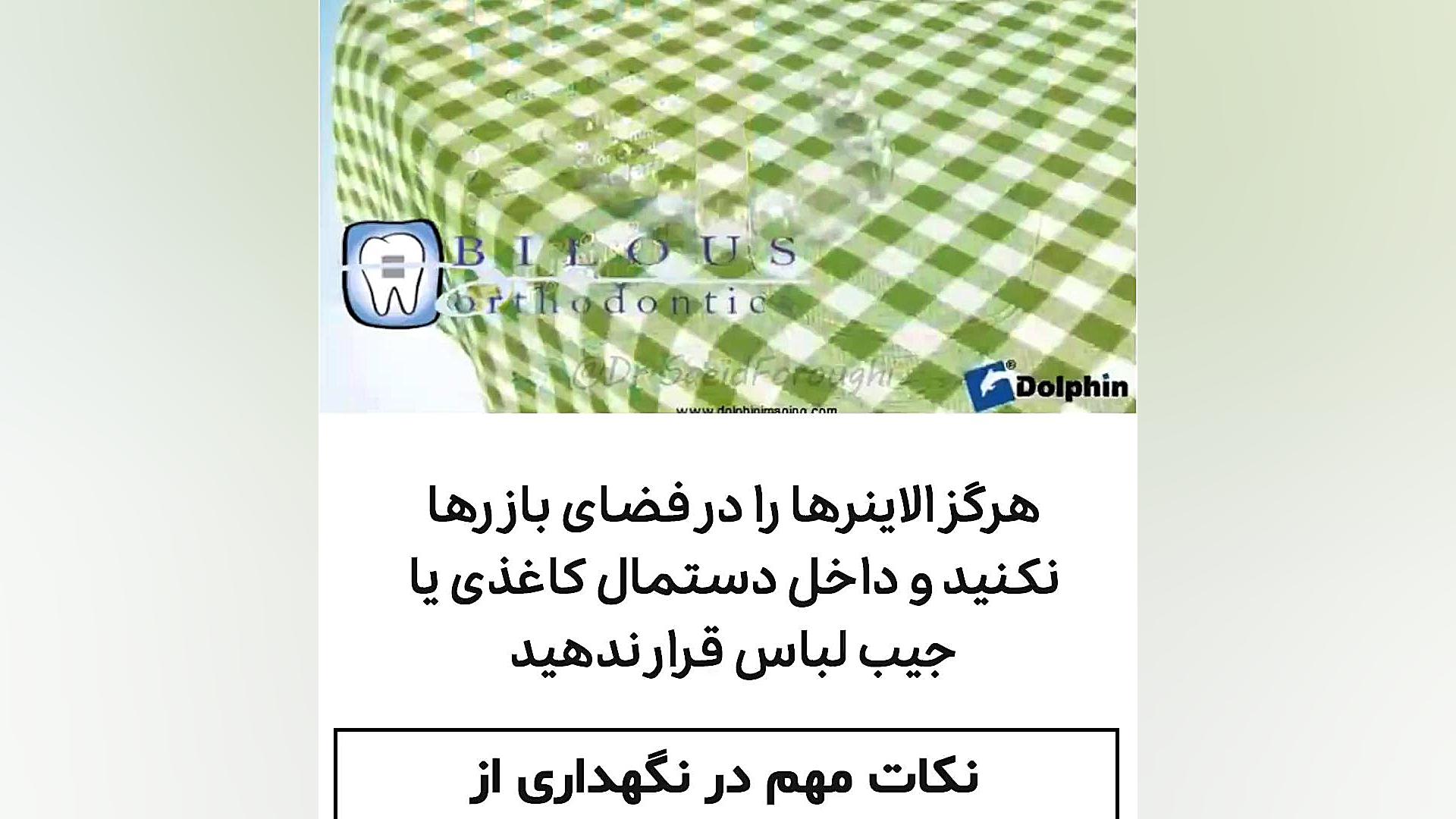 نکاتی در مورد نگهداری از الاینرهای شفاف دکتر سعید فروغی متخصص ارتودنسی