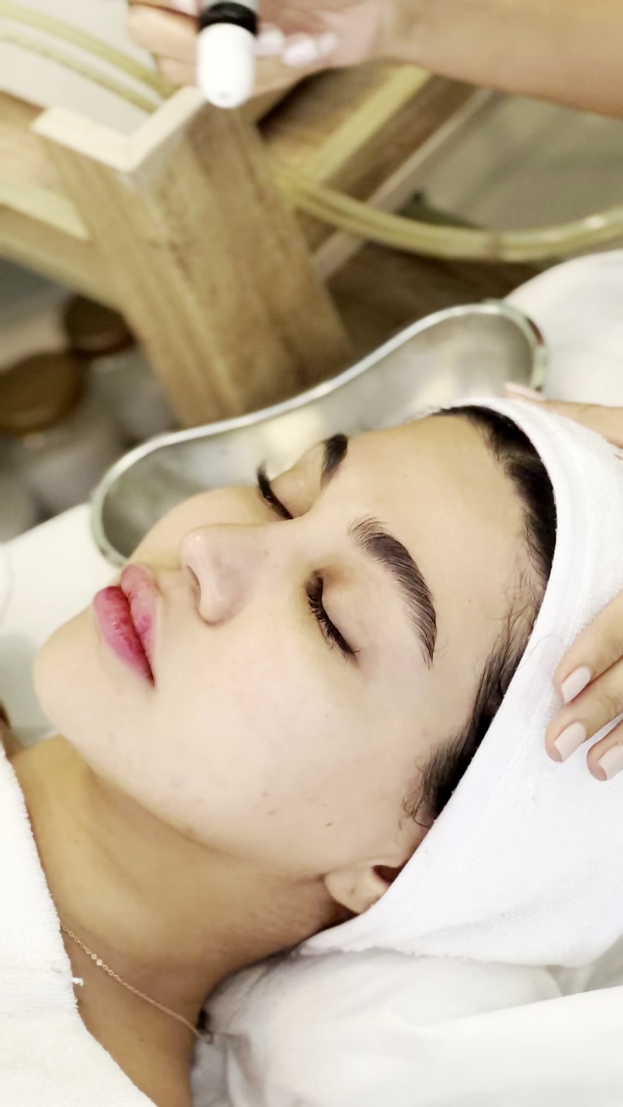 آموزش پاکسازی پوست |  میکرودرم ابرژن 09123887589