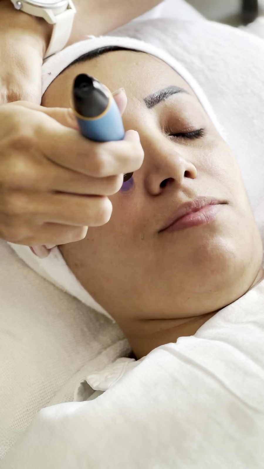 آموزش میکرونیدلینگ | آموز بی حسی به روش پانچ پانچ 09123887589