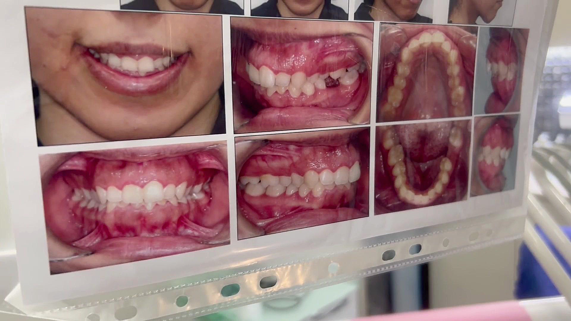 ارتودنسی دكتر مهدي فهيمي هنزائي