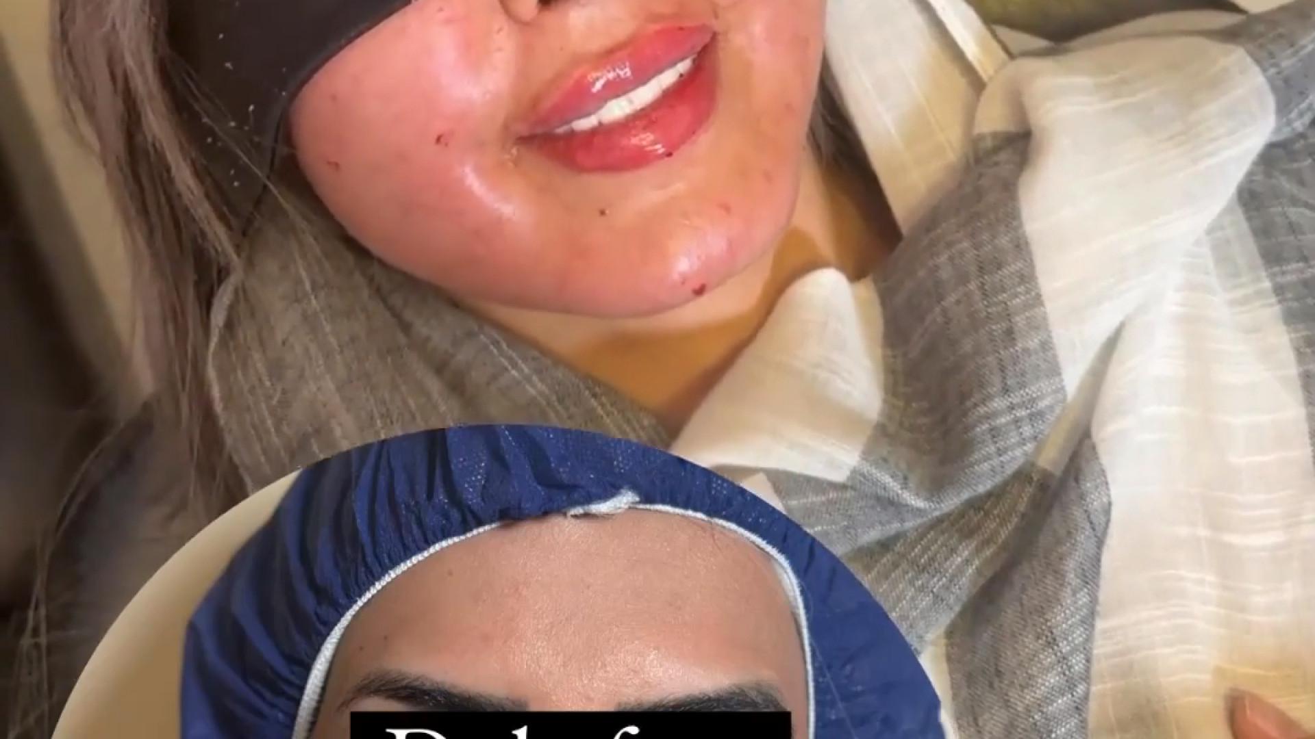 تزریق چربی به سبک دکتر الهام کفایی هولوگرام سه‌بعدی جراحی