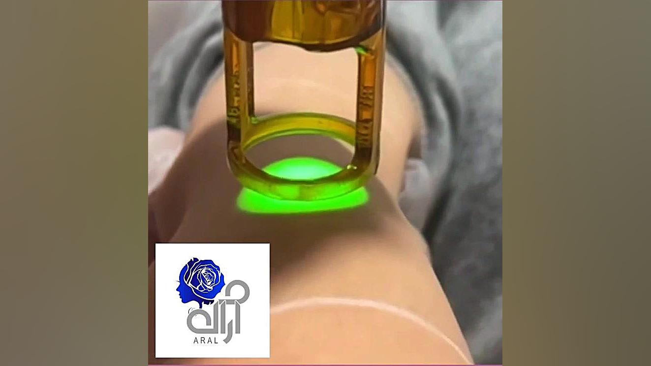 لیزر مو های زائد بدن ( آرال کلینیک) V/Q Scan