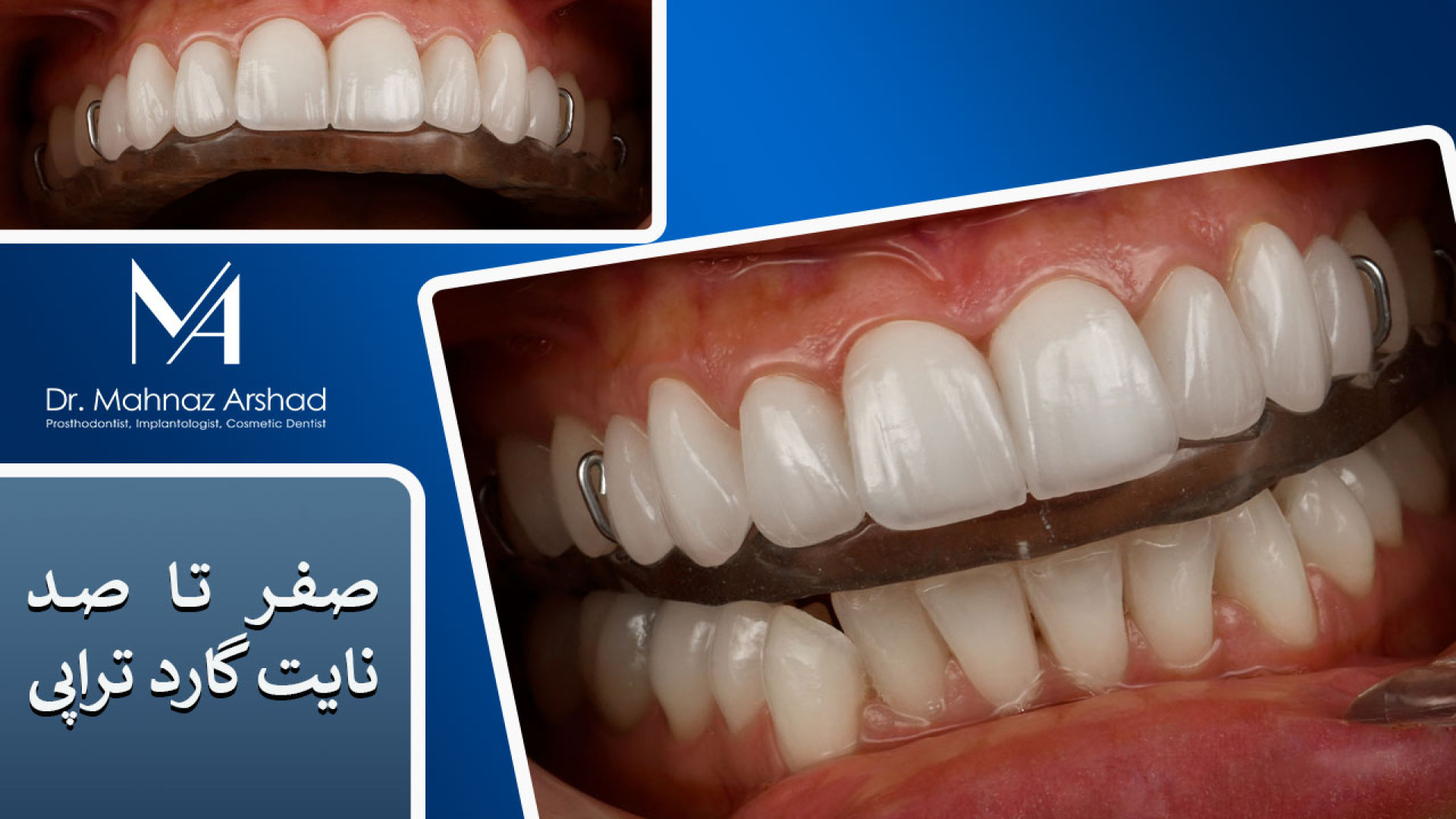 صفر تا صد نایت گارد تراپی دکتر مهناز ارشد