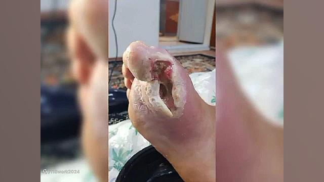 مرکز خدمات تخصصی پرستاری در منزل رها در رامسر آر اف فرکشنال