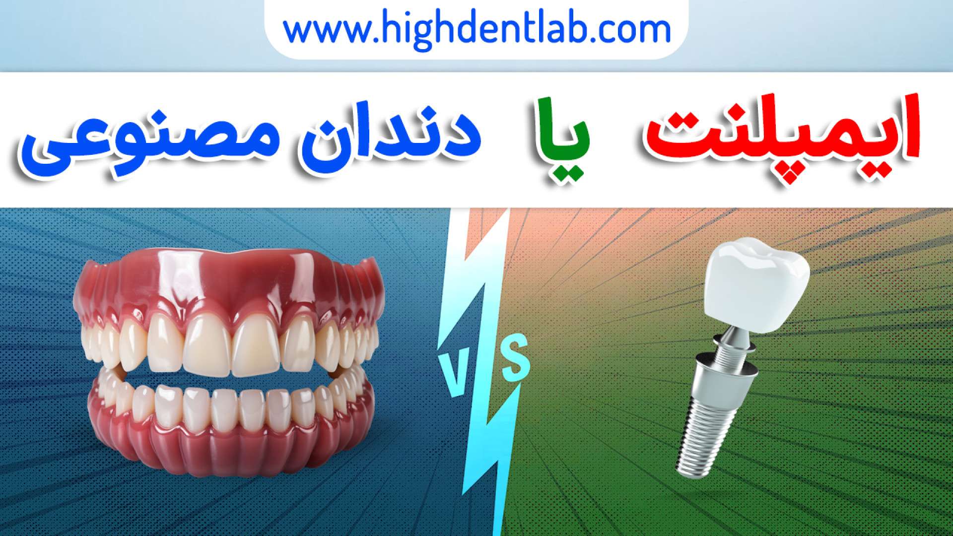 همه دندان‌هامو از دست دادم، ایمپلنت بزارم یا دندان مصنوعی؟ بیماری کارنی تین ناقل نقص اولیه