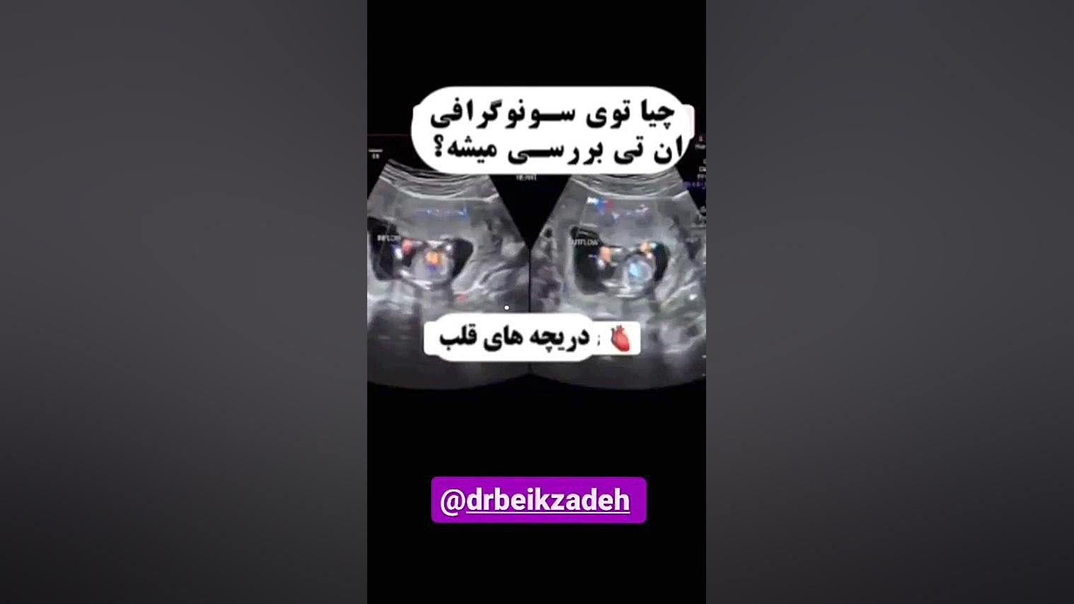 سونوگرافی nt چیست؟ دکتر مژگان بیک زاده ( جراح و متخصص زنان و زایمان)