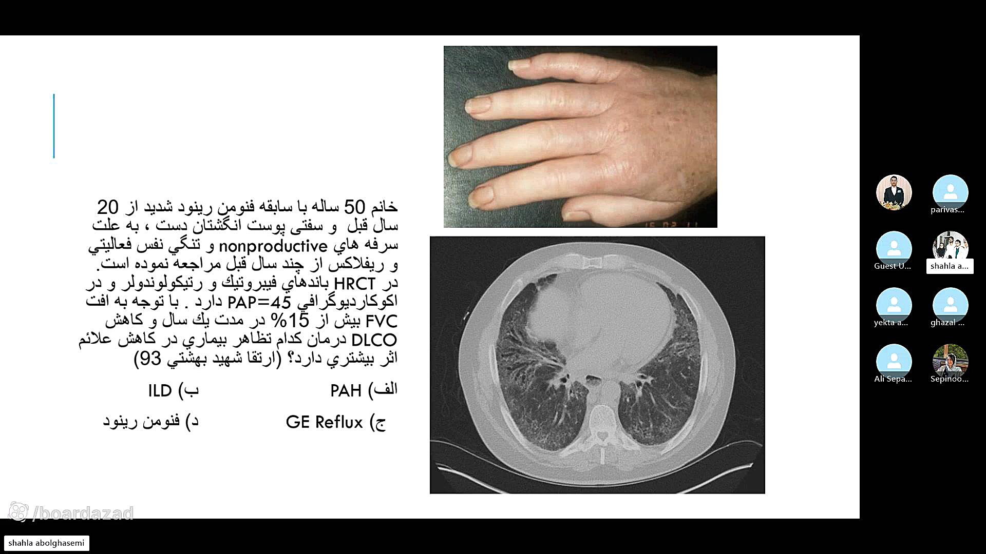 جلسه دوم تحلیل بورد داخلی 1402 - روماتولوژی - دکتر ابوالقاسمی فیلم خارجی