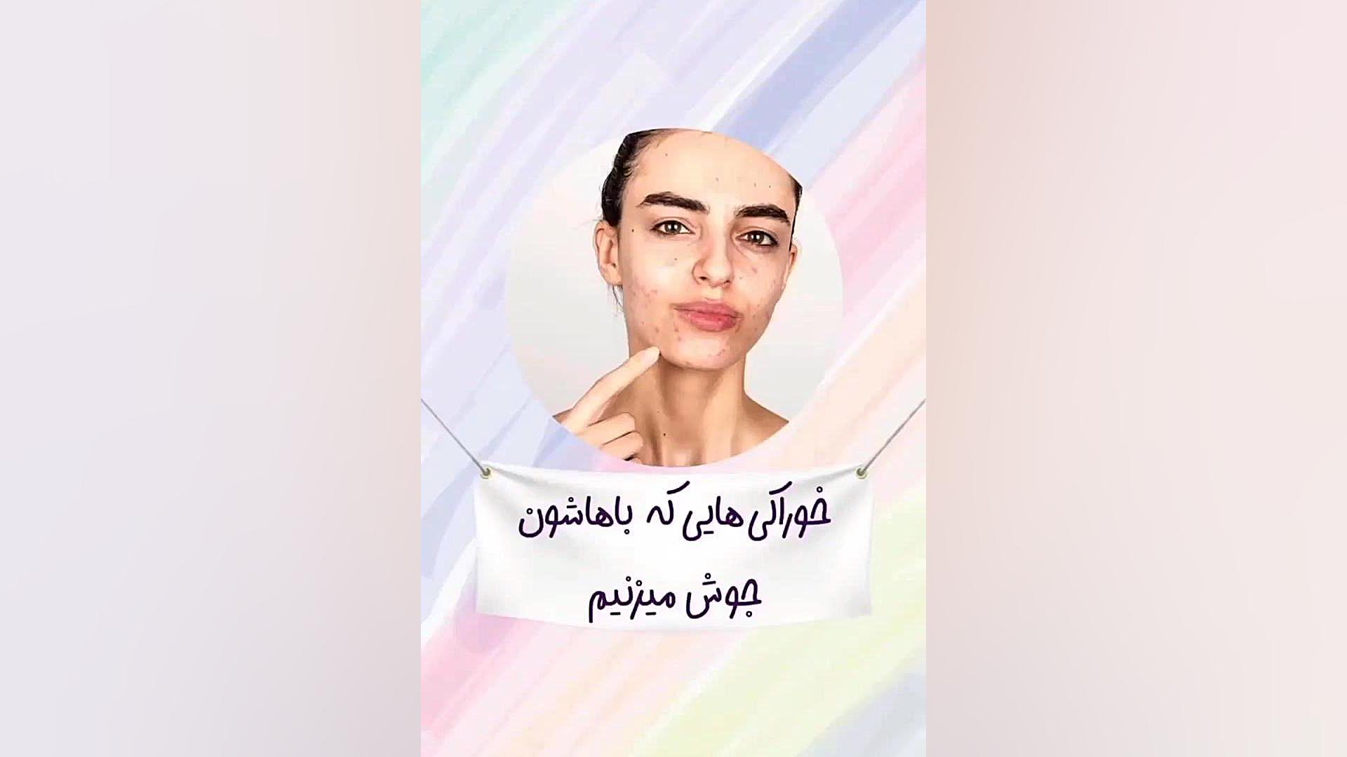 چه غذاهایی باعث جوش زدن می شوند؟ دکتر امیر سلیمانی