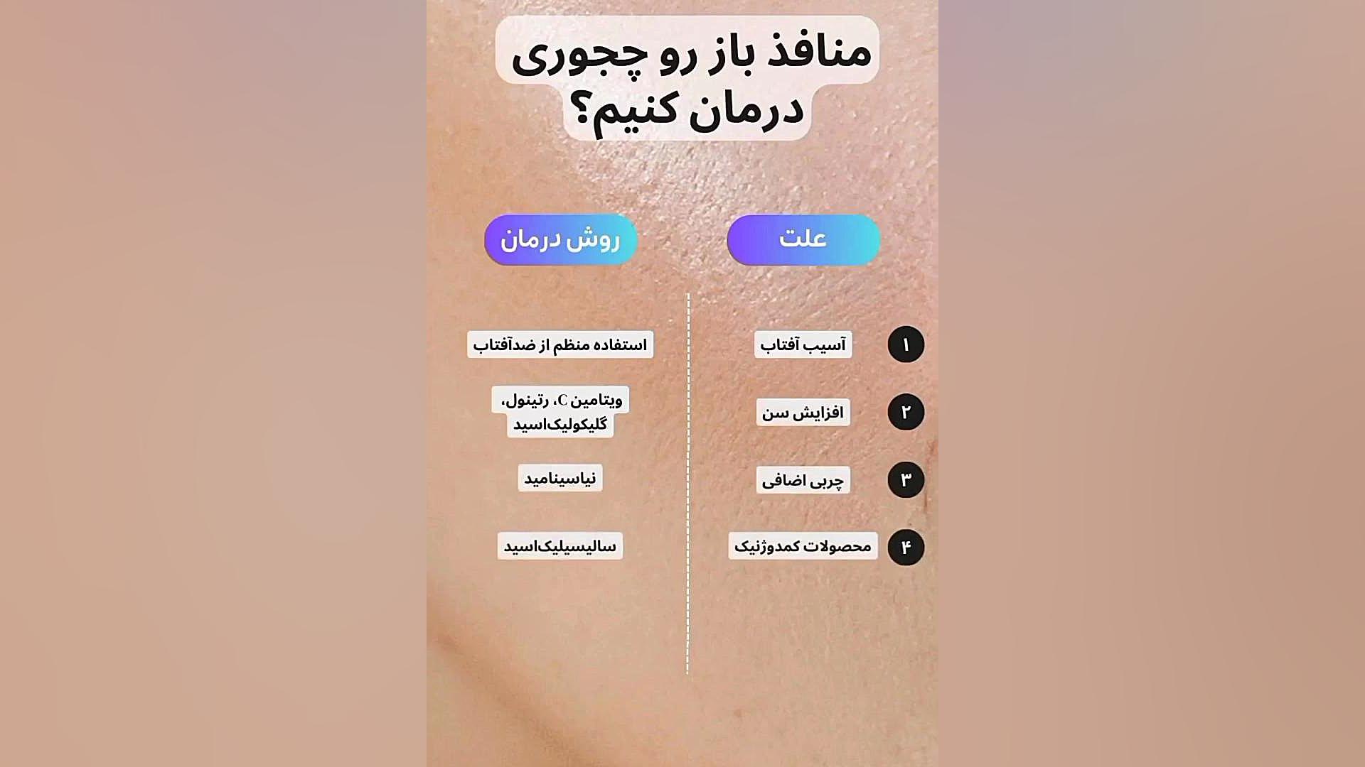 درمان منافذ باز پوست دکتر امیر سلیمانی