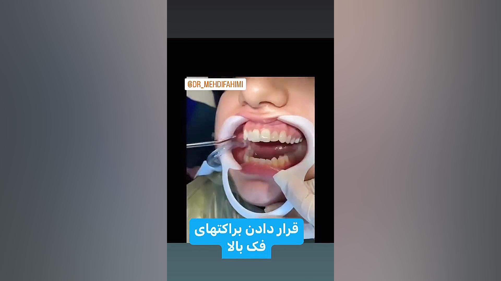 شروع ارتودنسی دكتر مهدي فهيمي هنزائي