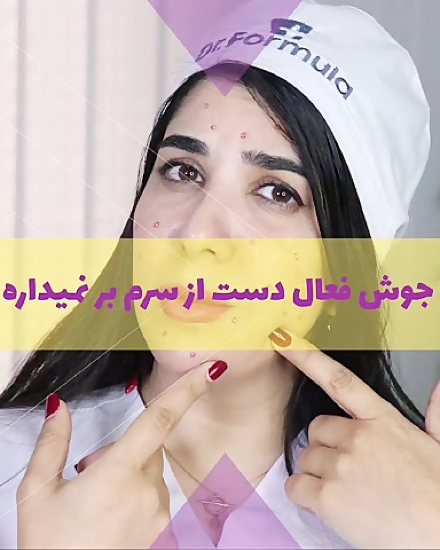 جوش فعال چیست و روش درمان آن